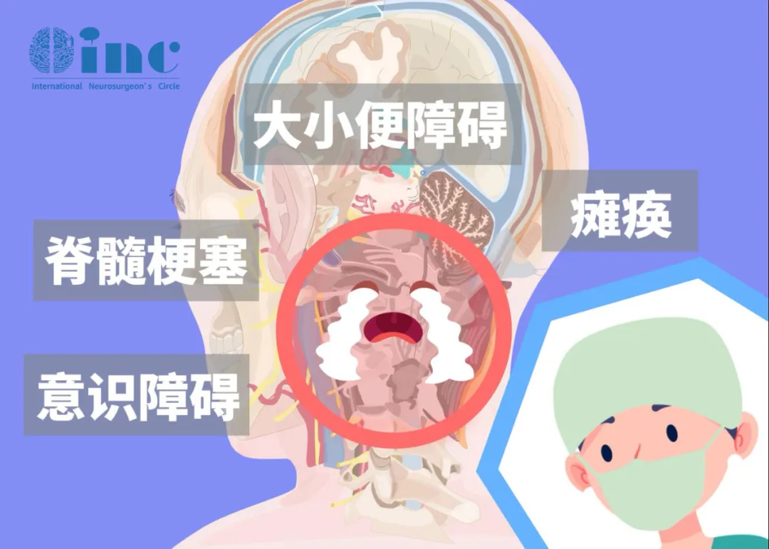 脊髓肿瘤患者常遇到的五大问题