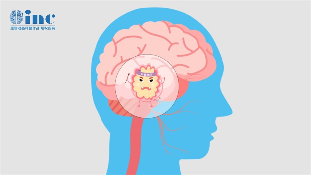 脑干转移瘤能做手术吗?难吗?