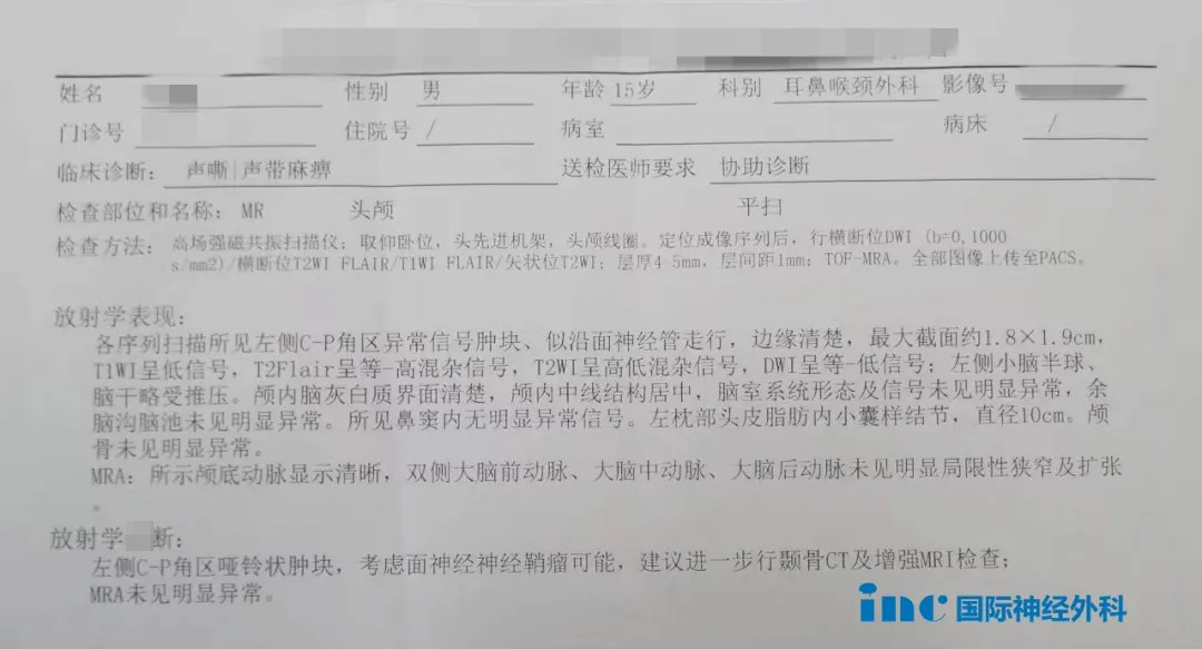 颈静脉孔区肿瘤