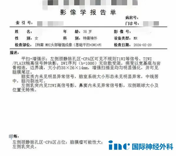 39岁女性-颈静脉孔区脑膜瘤报告单图片