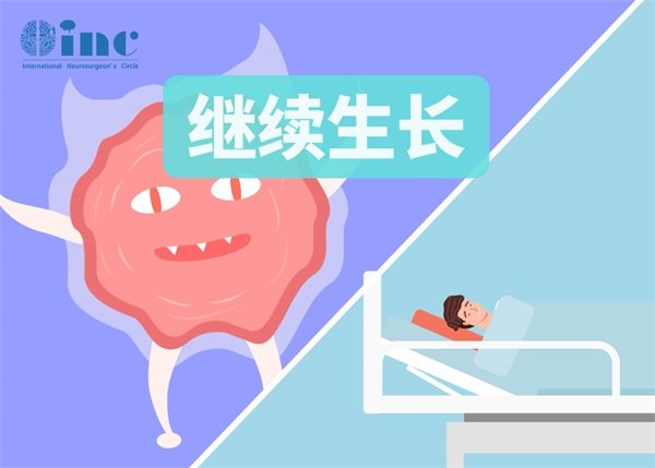 颅内软骨肉瘤生长有多快?