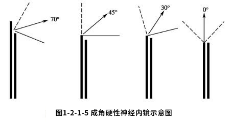 神经内镜