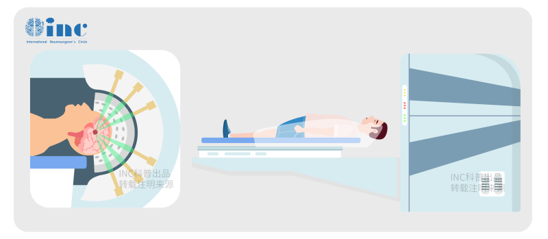 三叉神经鞘瘤手术后有哪些后遗症?