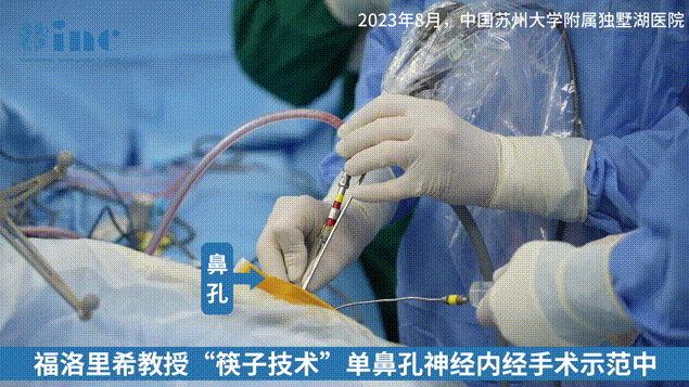 福教授经鼻神经内镜手术