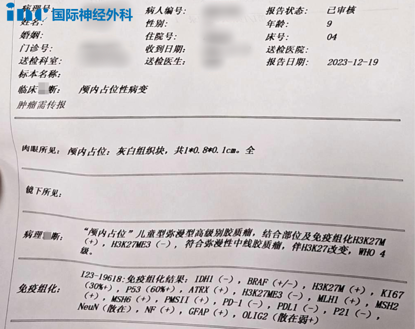 立体定向活检，病理结果显示如下：儿童弥漫性中线胶质，伴H3K27改变，WHO4 级。鉴于其30%的高Ki67指数，其生长速度相当快。