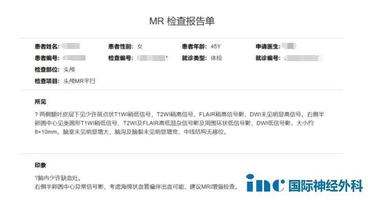 MR检查报告单
