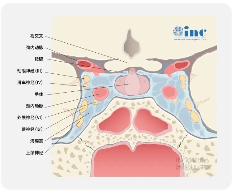 Meckel’s腔