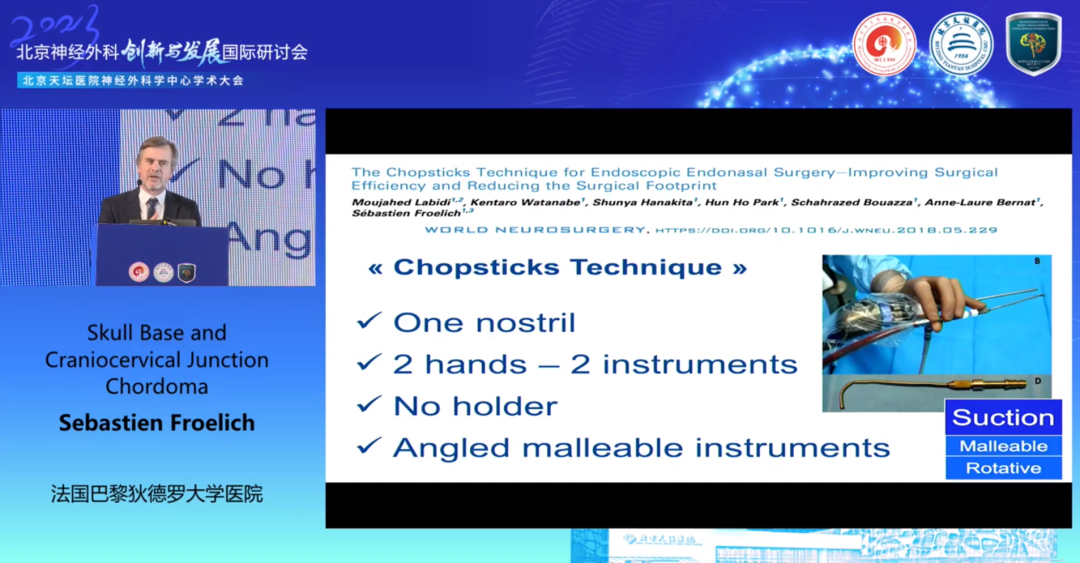 “筷子技术chopsticks technique”