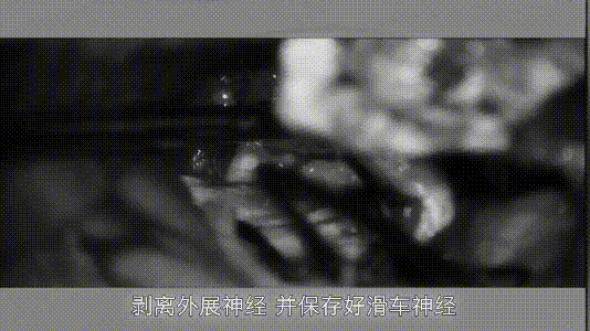 手术过程