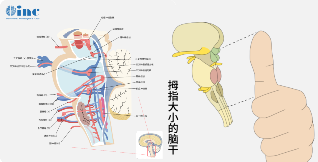 脑干是人的生命中枢，包括中脑、脑桥、延髓，脑干海绵状血管瘤会导致脑干出血，使病人出现肢体瘫痪、昏迷，甚至危及生命。