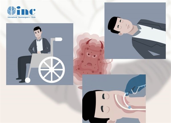 成人型弥漫性胶质瘤能治愈吗?有哪些新的治疗办法?