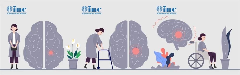 脑干占位(如肿瘤、出血或脓肿)在神经外科是非常严重的情况，可以压迫或破坏脑干的正常结构和功能，除了各种颅神经损伤(如肢体无力、麻木、视力下降、面瘫等)，还可以导致急性重症风险