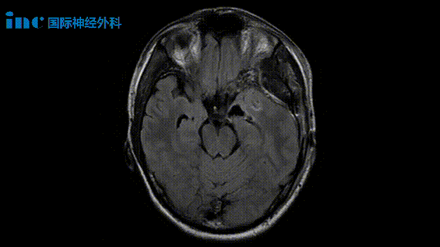 患者术后影像