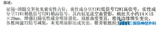 延颈髓交接处有占位