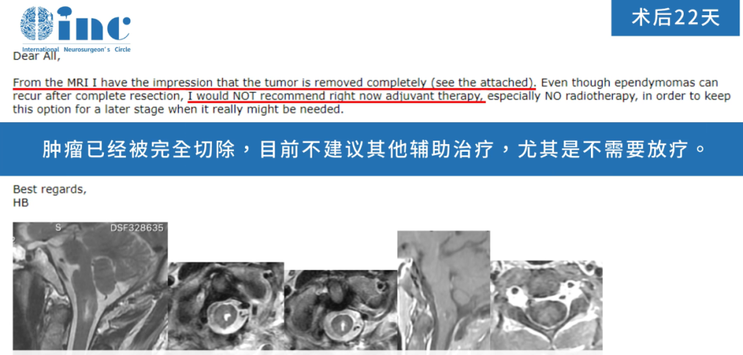 术后22天，巴教授在收到最新复查影像后为患者评估并邮件回复