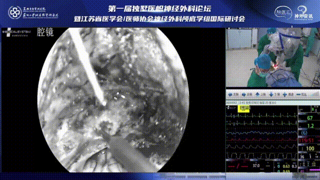 从寰椎后弓侧方进行解剖时要仔细，采用低功率烧灼参数，手术操作要仔细，避免造成动脉损伤及刺破硬脑膜或在分离肌肉时损伤椎动脉。