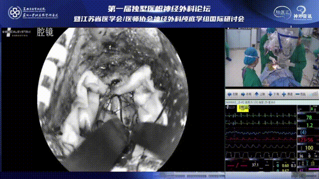 保证充分的骨瓣骨窗暴露是入路的关键，根据术中病灶的情况随时弥补骨窗暴露的不足，以达到更好的术野暴露。