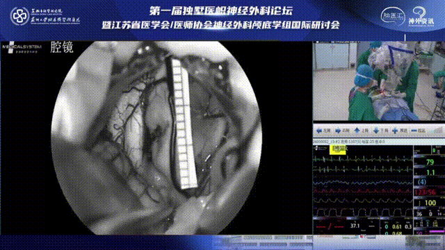 术中使用刻度尺提示术野范围约1.5cm