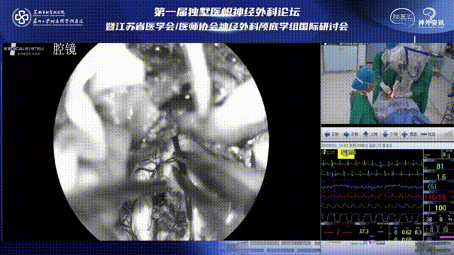 镜下可见海绵状血管瘤浸润突破延髓表面征象，从此处“突破口”作为脊髓表面切口，按序逐步分离肿瘤和脑组织。