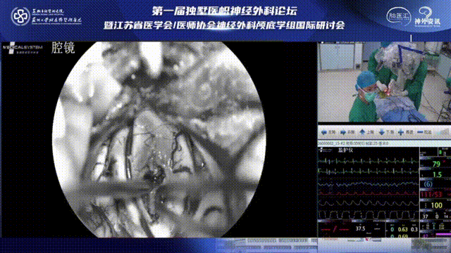 脊髓对侧病灶浸润突破延髓表面处做切口、钝性分离，使用由上至下按序逐步分离肿瘤和脑组织，避免过分牵拉脊髓造成神经损伤。