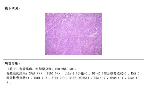 术后病理：室管膜瘤WHO 2级