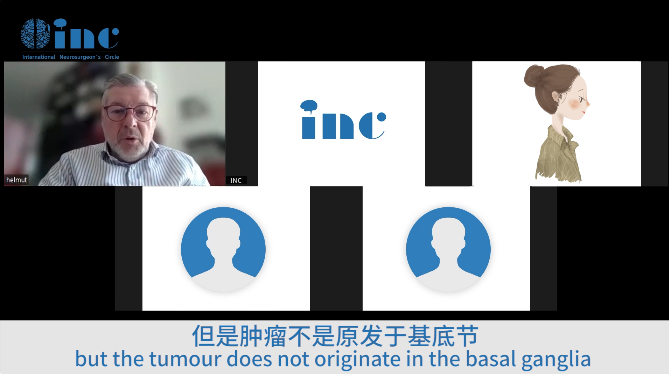 巴教授从肿瘤生长方式和手术中即将采用的入路，生动详细得为患儿家属解释着手术方案。