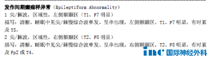 癫痫