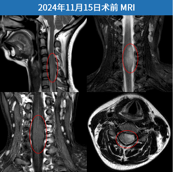 术前MRI