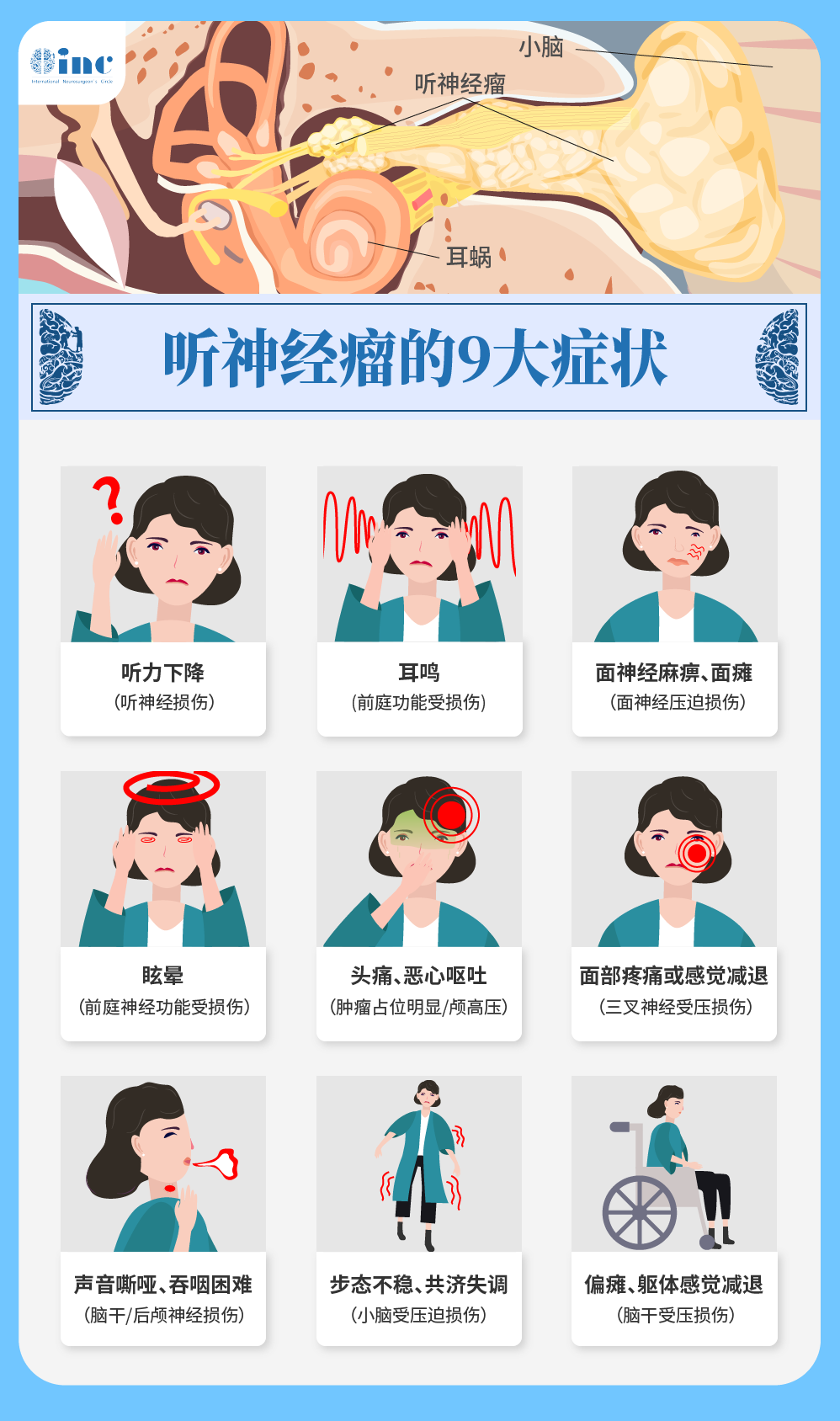 听神经瘤主要症状