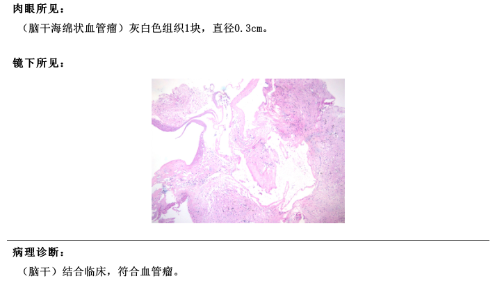 术后病理