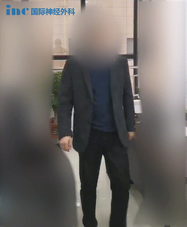 顺利全切术后1年随访视频，正常生活工作