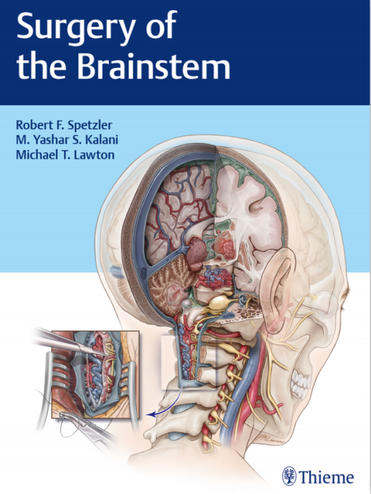 世界脑干手术专著《Surgery of the Brainstem》