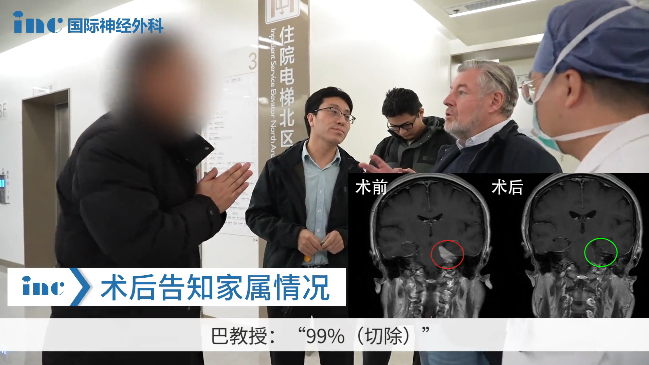 手术室外，结束手术后的巴教授第一时间内将这个好消息告诉了一直守护在外的方女士家人。