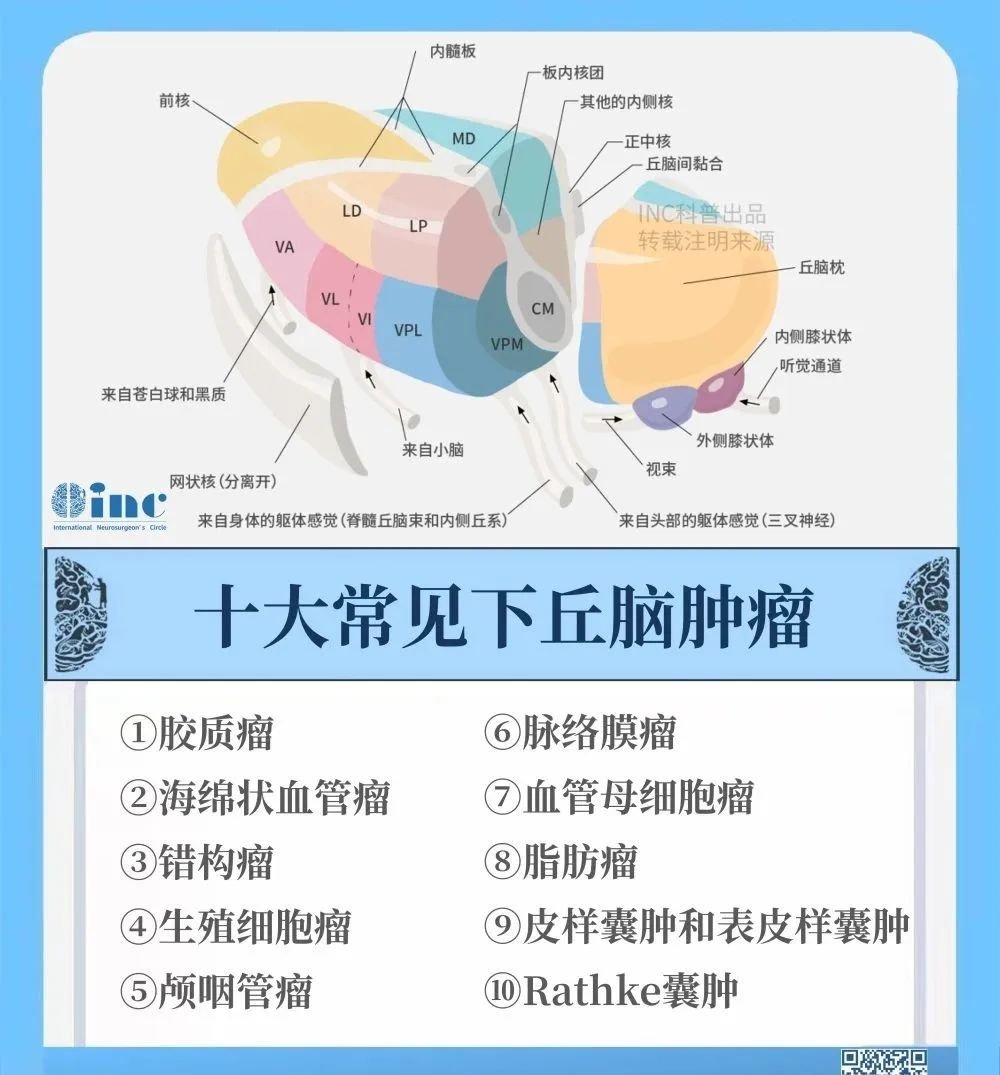 丘<a href='/naoliu/' target='_blank'><u>脑肿瘤</u></a>