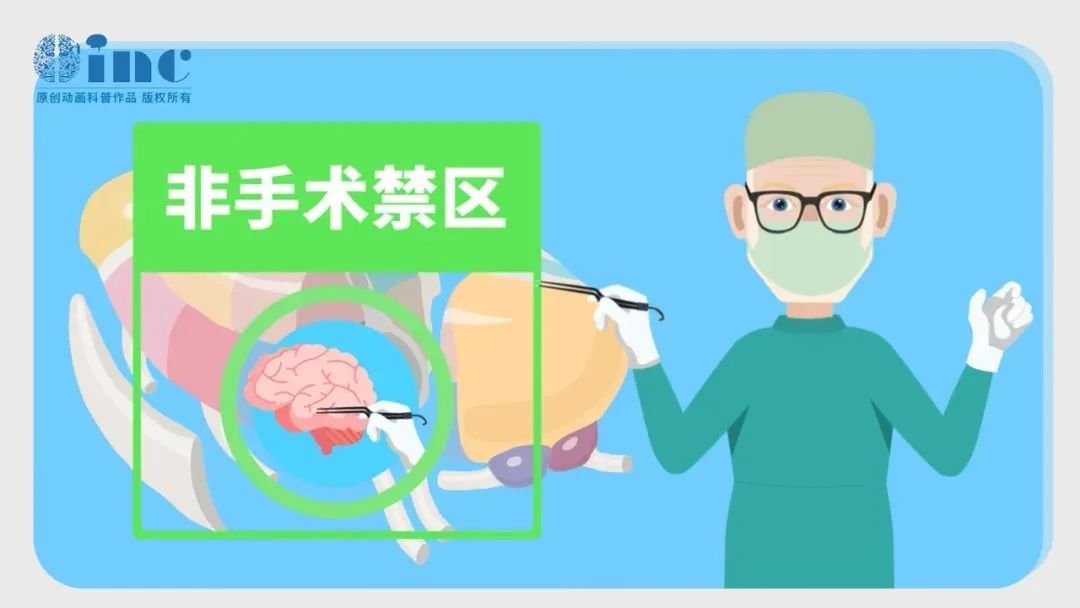 James T. Rutka教授尤其擅长儿童丘脑胶质瘤患者的个性化综合治疗，在他看来，丘脑不再是手术的“禁区”，而是需要勇气和能力的“战区”。