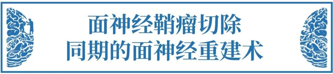 对于面神经鞘瘤患者，术中为了完整切除肿瘤，对面神经的损伤一般难以避免，因此，多考虑同期或二期行面神经重建术。