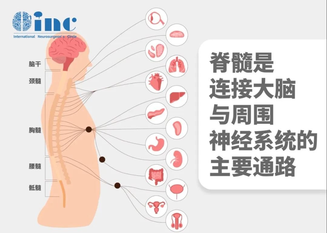 通俗来说，如果小脑扁桃体进入颈椎管内，就会造成拥挤，类似于公路上的堵车甚至撞车，导致患者因脊髓神经压迫和脑脊液循环不畅，出现压迫症状和脊髓空洞。