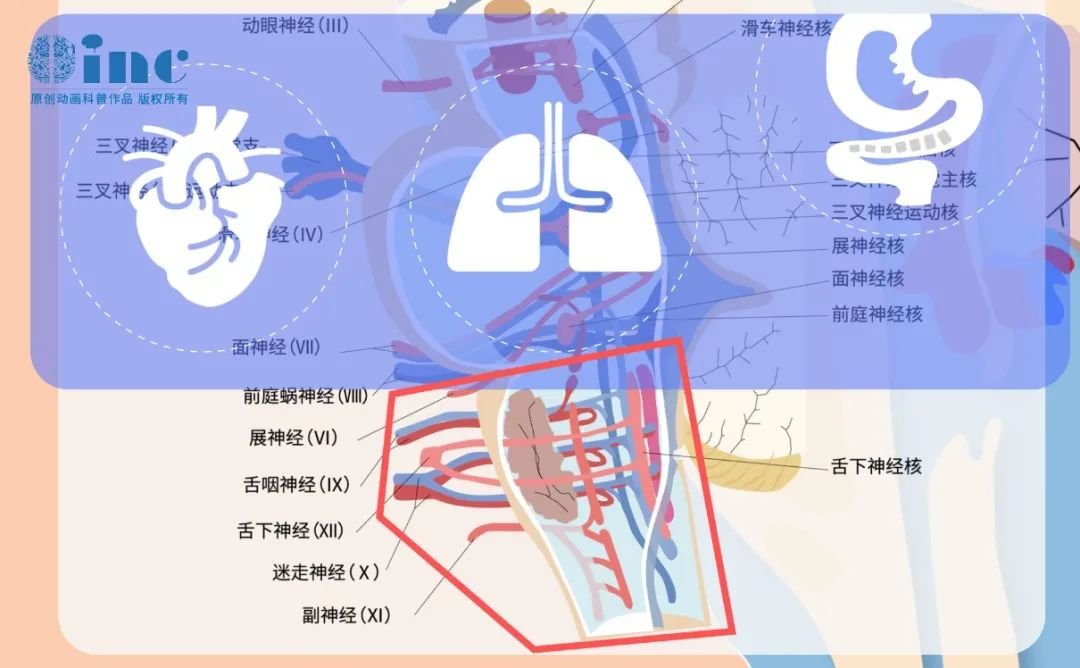 脑干下部偏右侧（累及延髓及脑桥下部）的弥漫性胶质瘤，病灶恰好位于第6至12颅神经的出入区