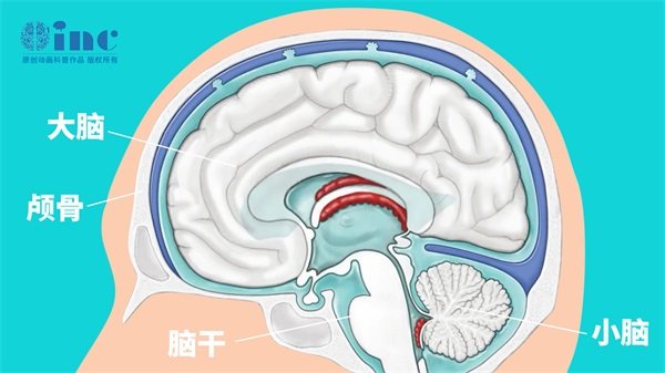 囊性动脉瘤