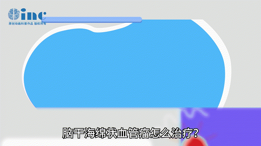 脑干海绵状血管瘤怎么治疗？