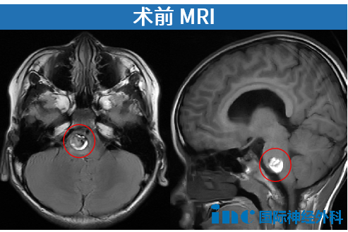 术前MRI影像