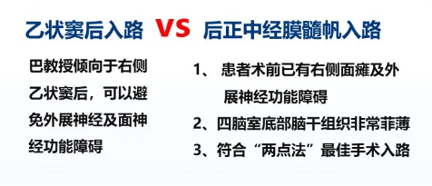 手术方案
