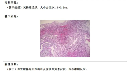 术后病理