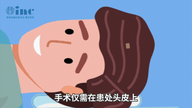 LITT 工作原理