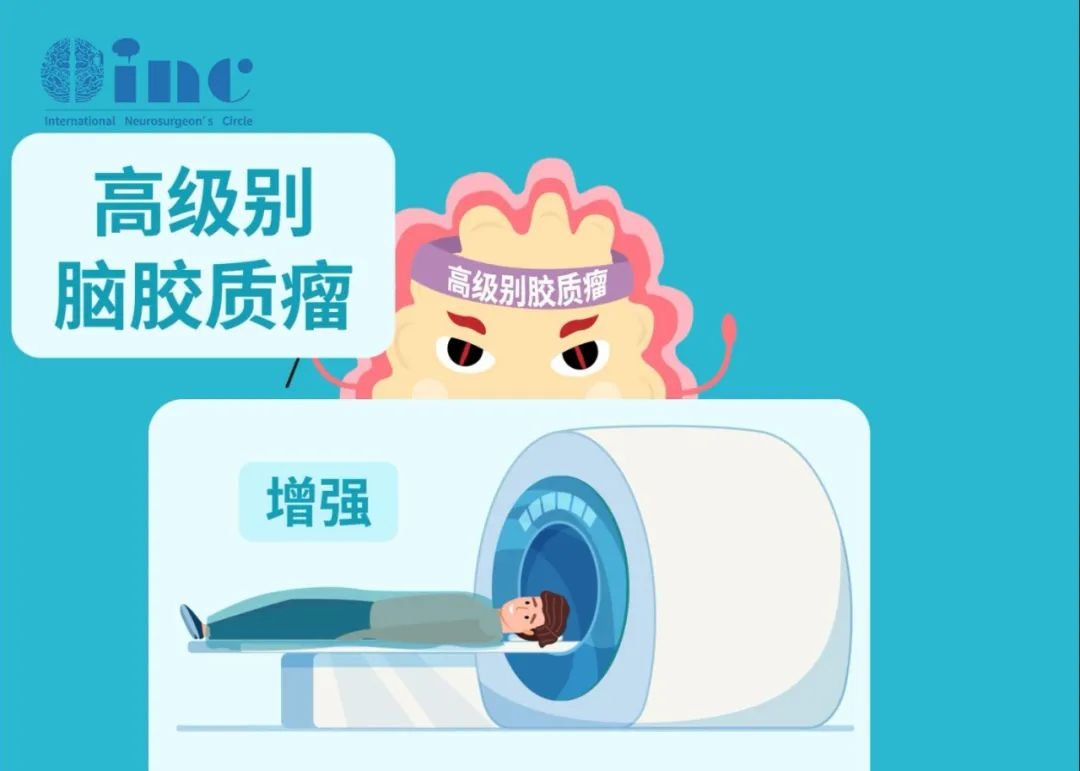 高级别脑胶质瘤