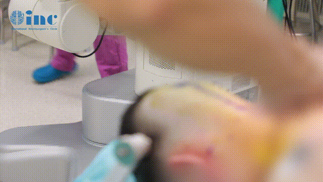 切口消毒