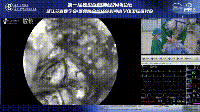 继续分离肿瘤和脑组织，注意避免出血，在切除病变过程中注意钝性分离、避免使用双极电凝损伤脊髓。