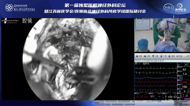 瘤腔、术野止血，水密缝合脑膜，关颅，患者全程呼吸、心跳平稳，手术顺利。