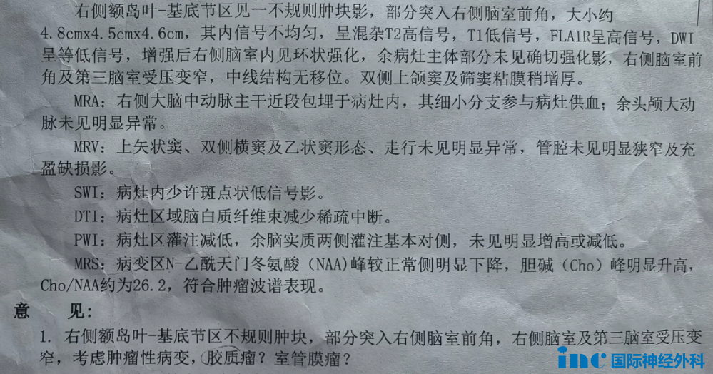 “右额颞、基底节区、右侧脑室前角区占位病变：胶质瘤可能性大。”
