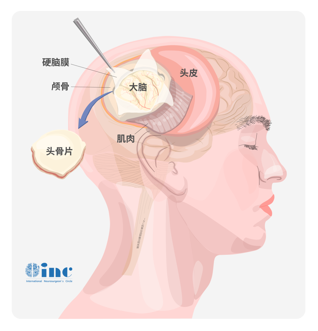 脑膜